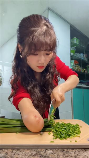 剛出生被橡皮筋致左手截肢，單手媽媽，把煙火日子過得閃閃發光
