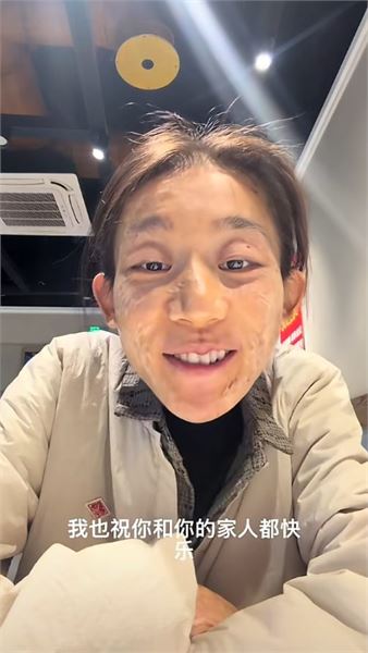 因火災留下傷疤，陳加瓦回應大家最關心的幾個問題