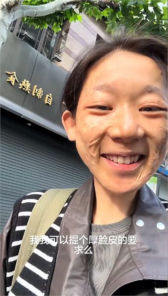 因火災留下傷疤，陳加瓦回應大家最關心的幾個問題
