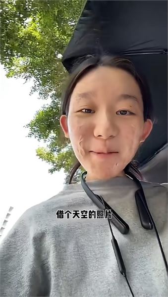 因火災留下傷疤，陳加瓦回應大家最關心的幾個問題